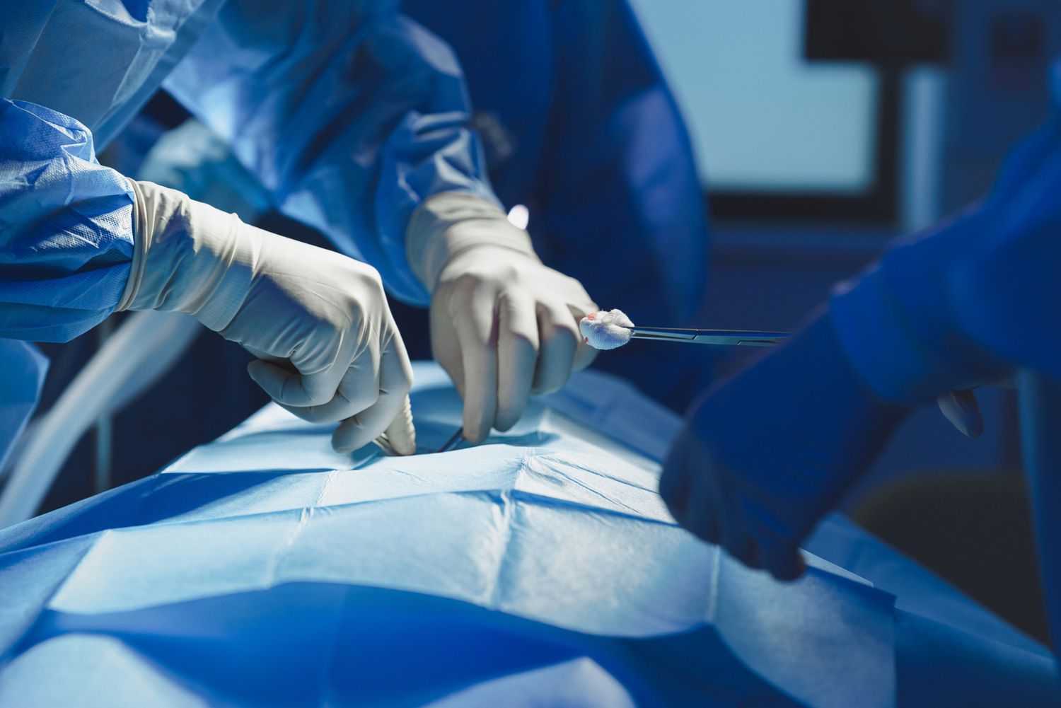 You are currently viewing Kentucky man wakes during organ harvesting – federal probe
