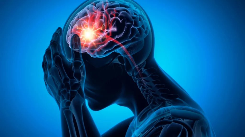 man headache brain stroke