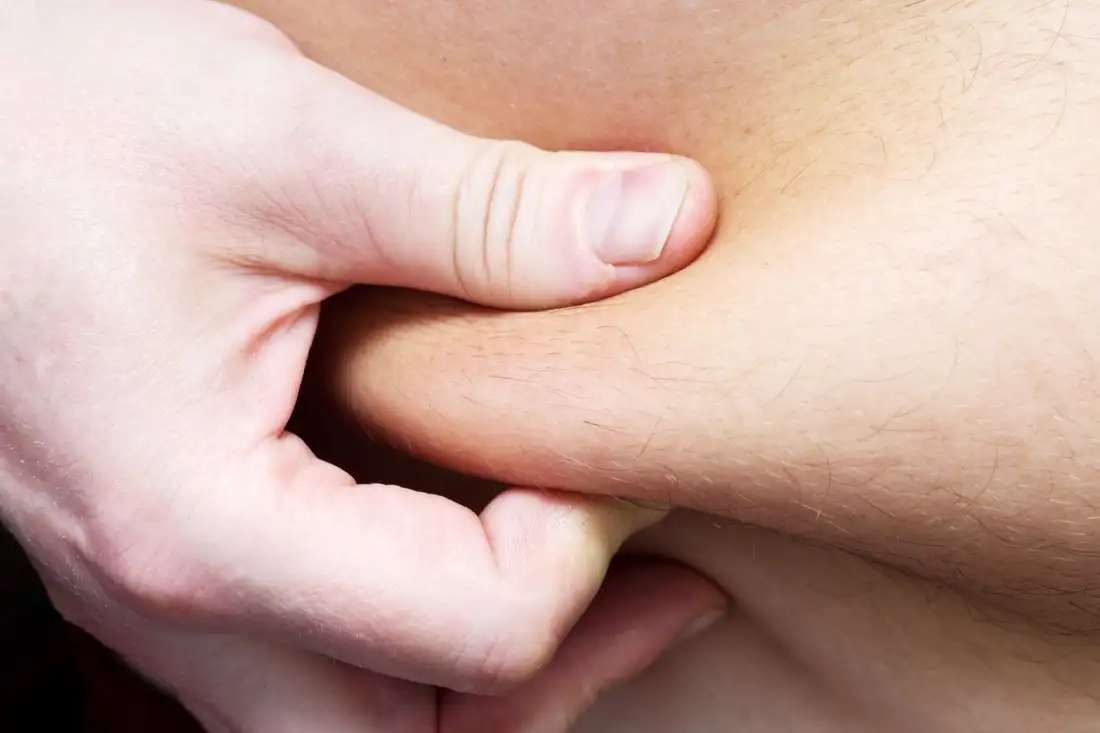 Read more about the article Body Fat Isn’t the Enemy: New Science Reveals Its Surprising Role in Protecting Human Health