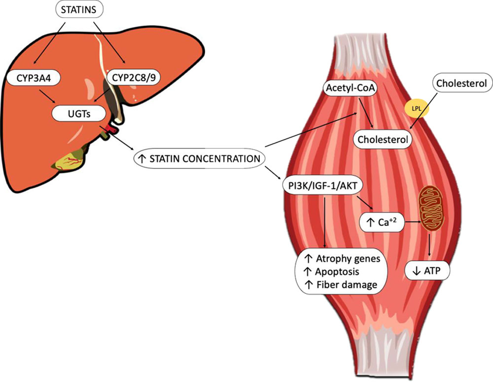 Statins Muscle Pain Mystery Finally Solved, Revealing Why Millions Experience Unexpected Side Effects
