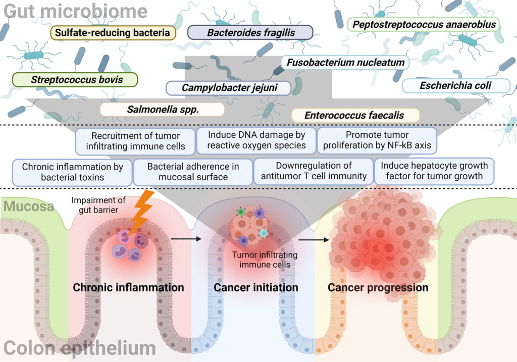 New Gut Virus Discovery May Change How Doctors Detect Colorectal Cancer Early