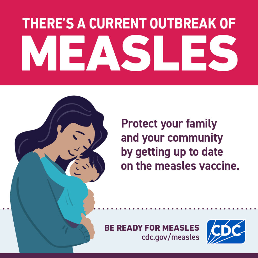measles outbreak current