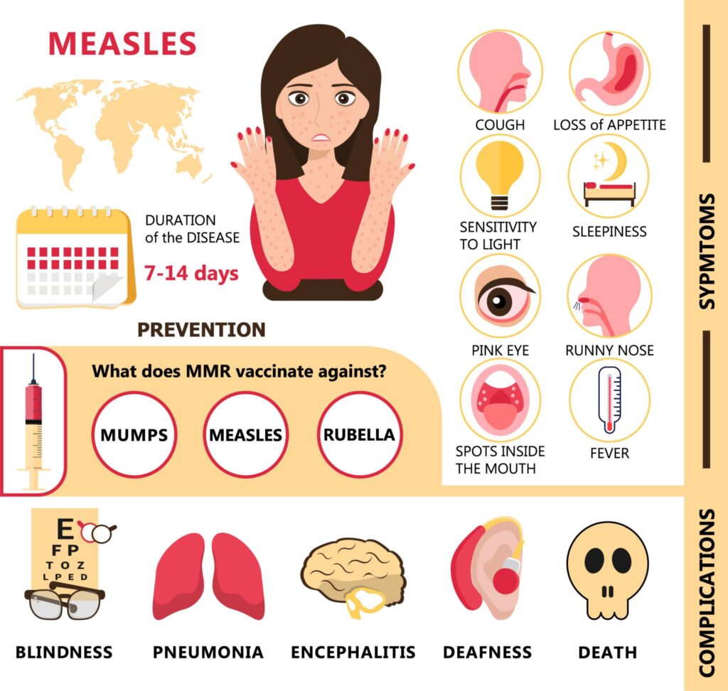 U.S. Measles Cases Surge Toward 1,000 in Early 2026, Raising Urgent Public Health Concerns
