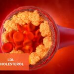 2026 Cholesterol Guidelines: What the New Recommendations Mean for Heart Health