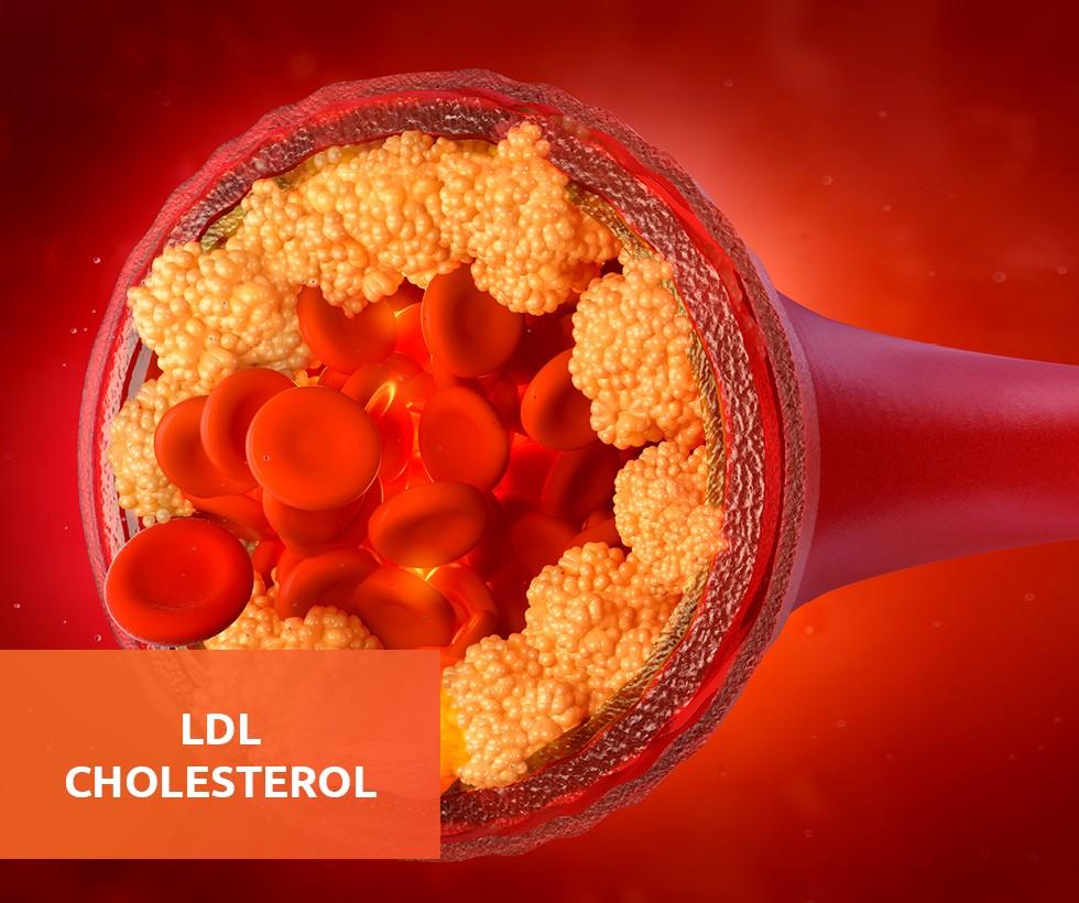 2026 Cholesterol Guidelines: What the New Recommendations Mean for Heart Health
